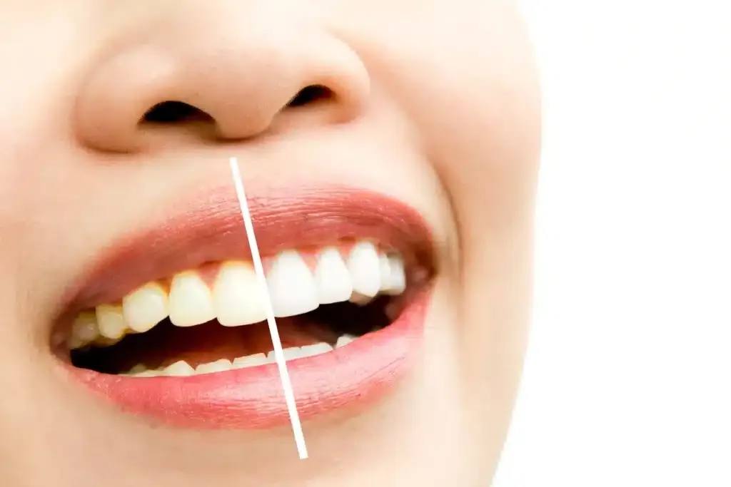 Person achieving a brighter Smile